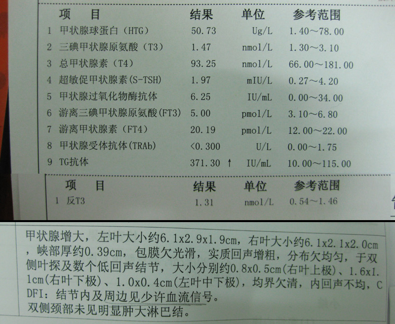 验血TG是什么-验血TG是什么意思